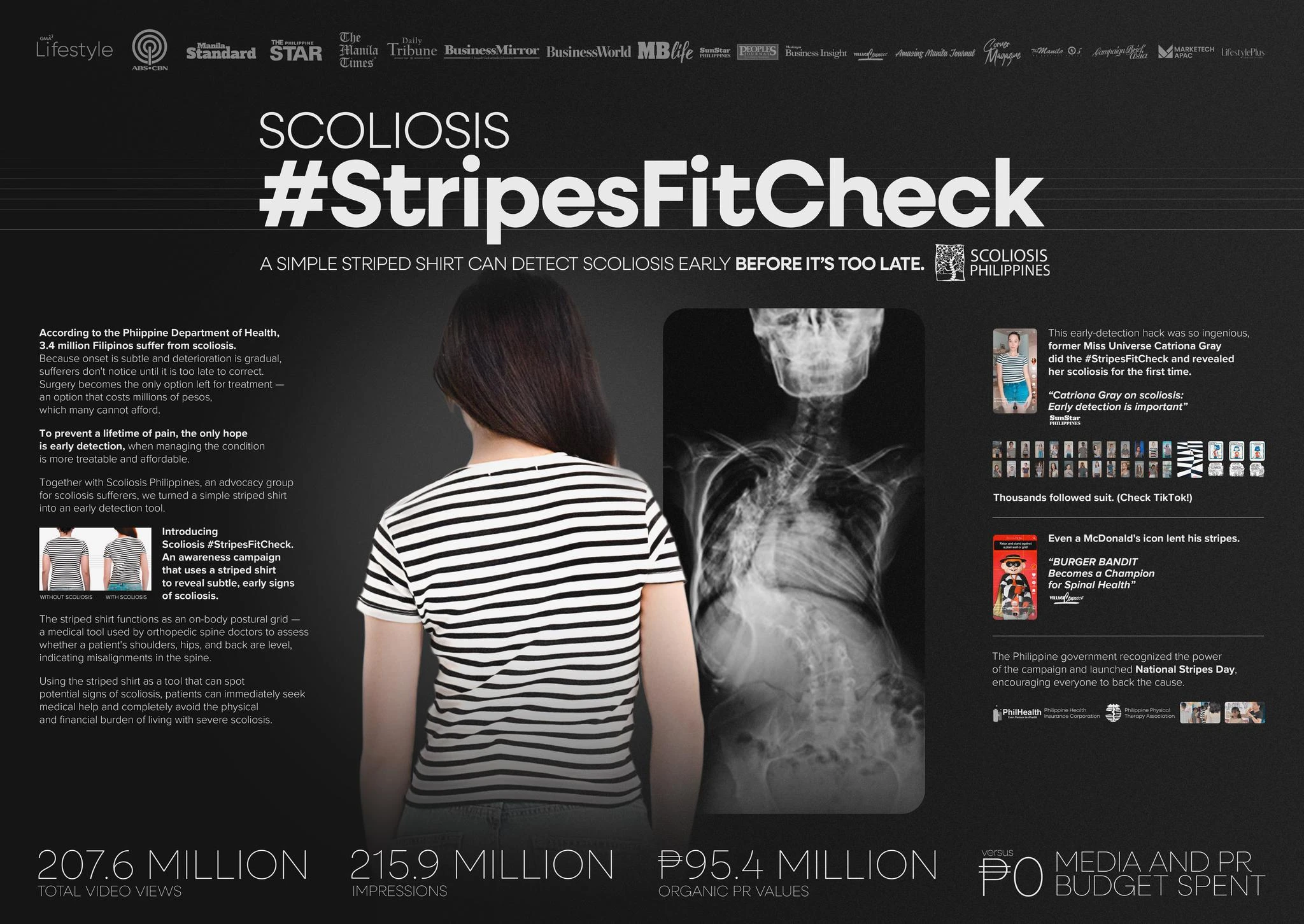 SCOLIOSIS #STRIPESFITCHECK