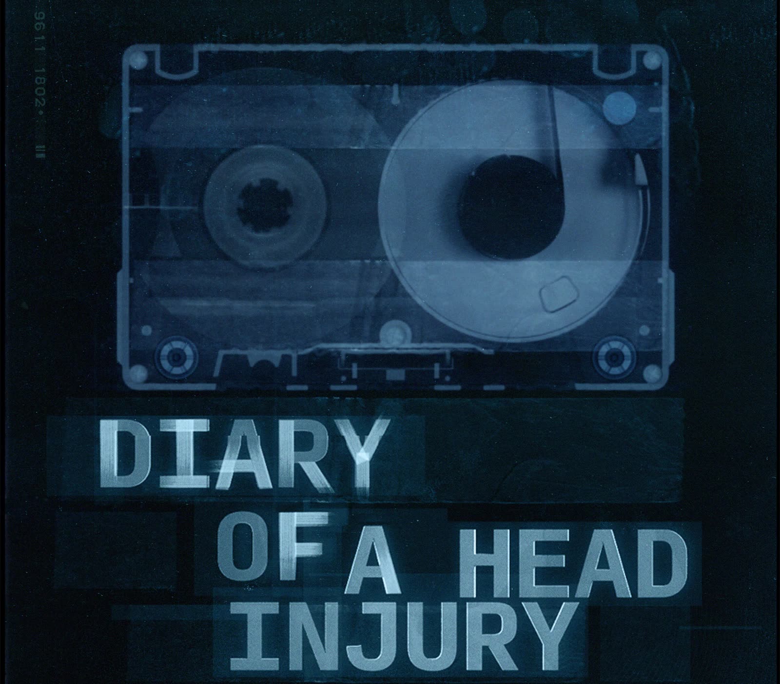 DIARY OF A HEAD INJURY