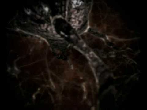 ALZHEIMER - image 2