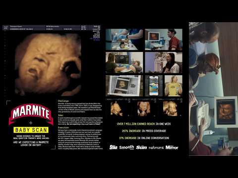 BABY SCAN - image 2
