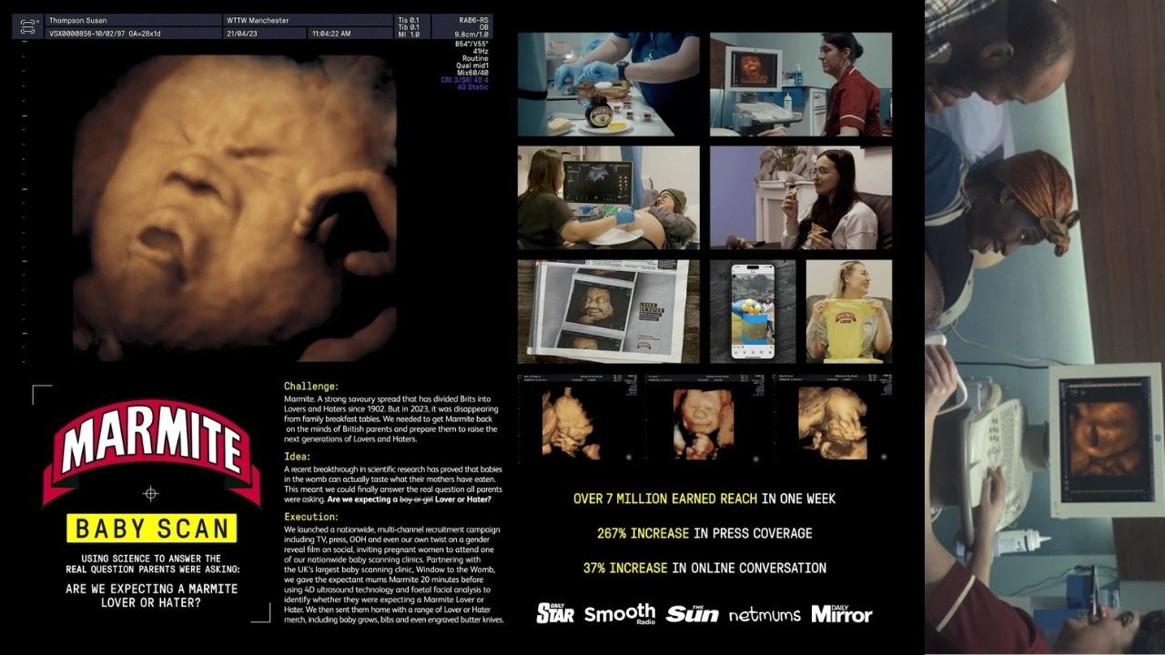 BABY SCAN - image 1