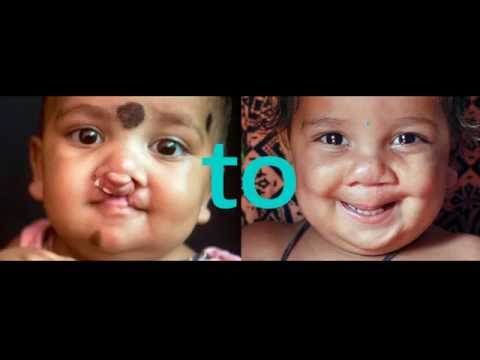 :{TO:) #CLEFTTOSMILE - image 2