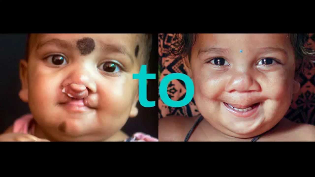 :{TO:) #CLEFTTOSMILE - image 1