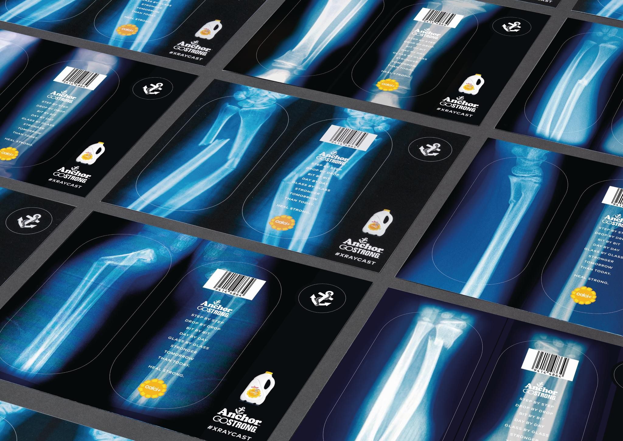 X-RAY CASTS - image 1